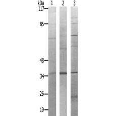 兔抗PTGR2多克隆抗體