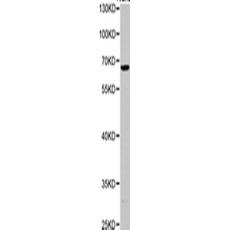 兔抗NUMBL多克隆抗體