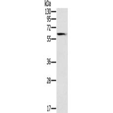 兔抗SLC45A3多克隆抗體