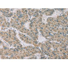 兔抗RNASE3多克隆抗體