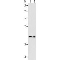 兔抗SERPINA5多克隆抗體