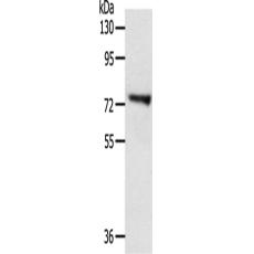 兔抗TRIM32多克隆抗體