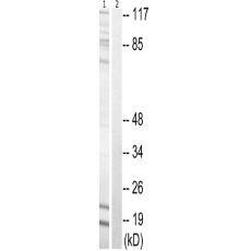 兔抗STMN1(Phospho-Ser62) 多克隆抗體
