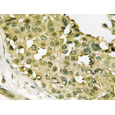 兔抗STMN1(Phospho-Ser62) 多克隆抗體