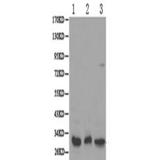 兔抗PSME3多克隆抗體