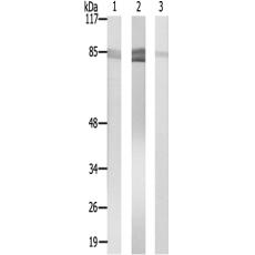兔抗SLCO1A2多克隆抗體