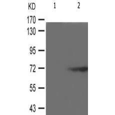 兔抗RPS6KB1(Phospho-Ser371)多克隆抗體