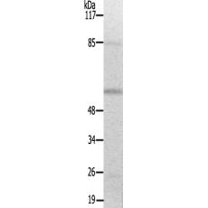兔抗PAK2(Ab-141)多克隆抗體