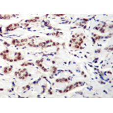 兔抗STAT5A (Phospho-Tyr694)多克隆抗體