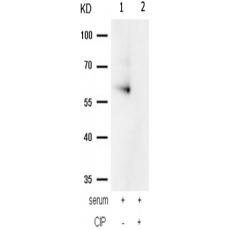 兔抗PRKAA1 PRKAA2(Phospho-Thr183 Thr172)多克隆抗體 
