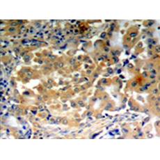 兔抗PRKCZ(Phospho-Thr410)多克隆抗體