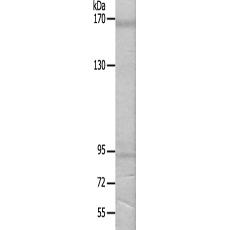 兔抗MRC2多克隆抗體