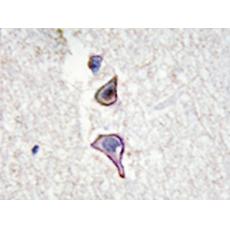 兔抗MRC2多克隆抗體