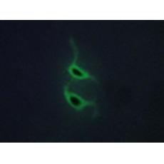 兔抗MRC2多克隆抗體