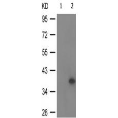兔抗NFKBIA(Phospho-Tyr305)多克隆抗體