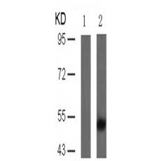兔抗MAPT (Phospho-Thr205)多克隆抗體