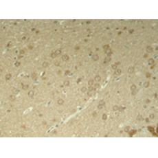 兔抗MAPT (Phospho-Thr205)多克隆抗體
