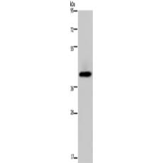 兔抗SERPINB3多克隆抗體 