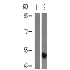 兔抗MAPT (Phospho-Ser404)多克隆抗體