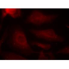 兔抗MAPT (Phospho-Ser404)多克隆抗體