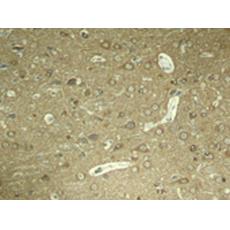 兔抗MAPT (Phospho-Ser404)多克隆抗體