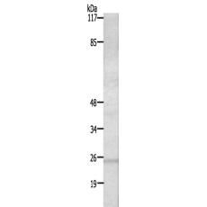 兔抗RIT1多克隆抗體 
