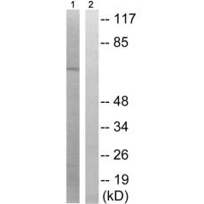 兔抗PAK1(Phospho-Ser204)多克隆抗體