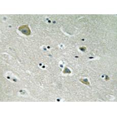 兔抗PAK1(Phospho-Ser204)多克隆抗體