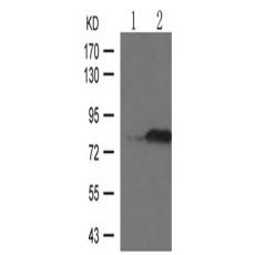 兔抗PRKCB (Phospho-Thr641)多克隆抗體