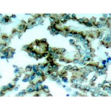 兔抗PRKCB (Phospho-Thr641)多克隆抗體