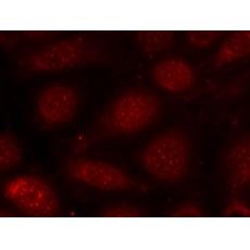兔抗PRKCB (Phospho-Thr641)多克隆抗體
