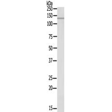 兔抗RANBP17多克隆抗體  