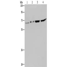 兔抗HACL1多克隆抗體 